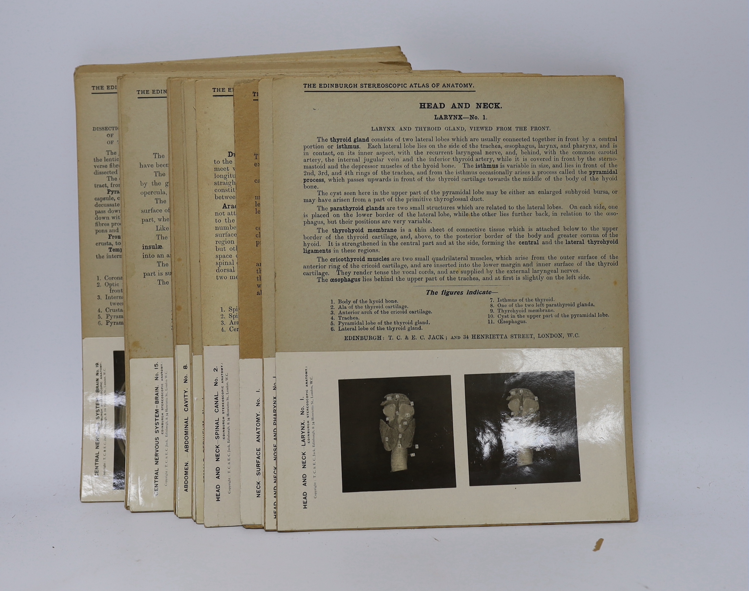 Stereoscopic cards from a set by The Edinburgh Stereoscopic Atlas of Anatomy with detailed information above the photographs, together with a small number of additional cards of different subjects